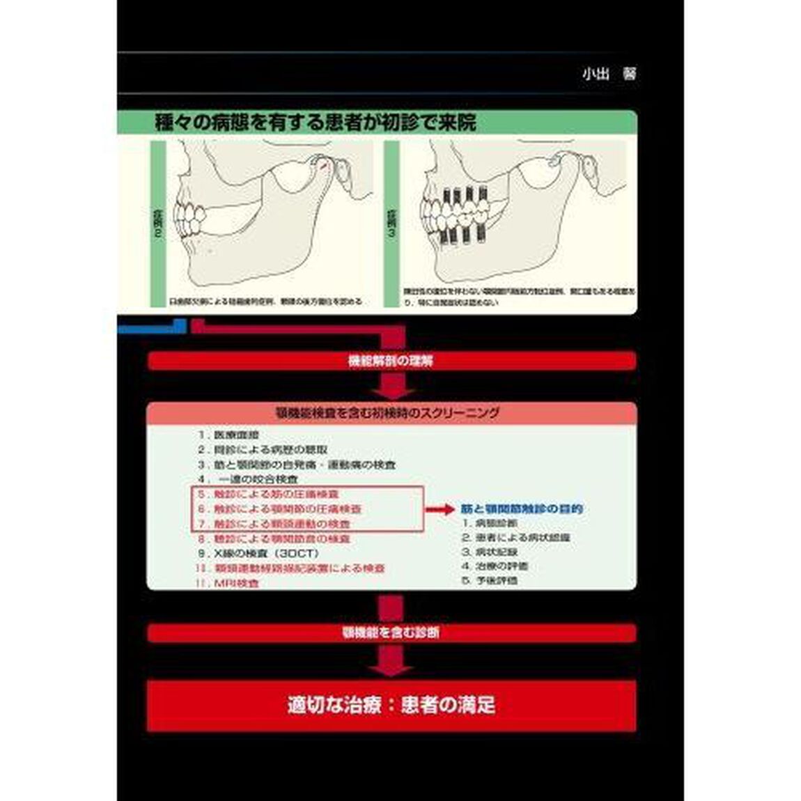 チェアサイドで行う顎機能検査のための基本機能解剖