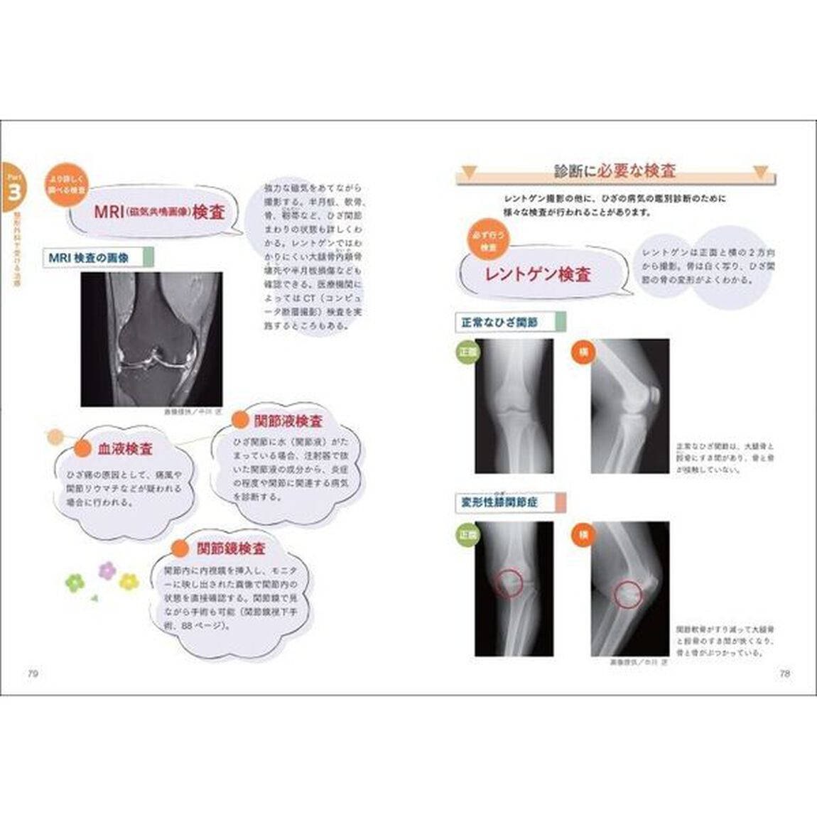 自分でできるひざ体操　変形性膝関節症のトラブルを解消