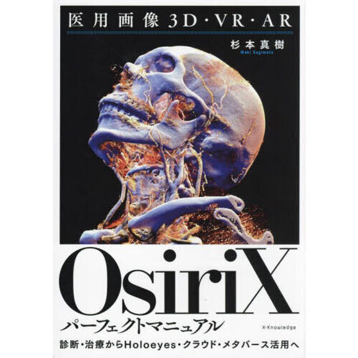 ＯｓｉｒｉＸパーフェクトマニュアル　医用画像３Ｄ・ＶＲ・ＡＲ