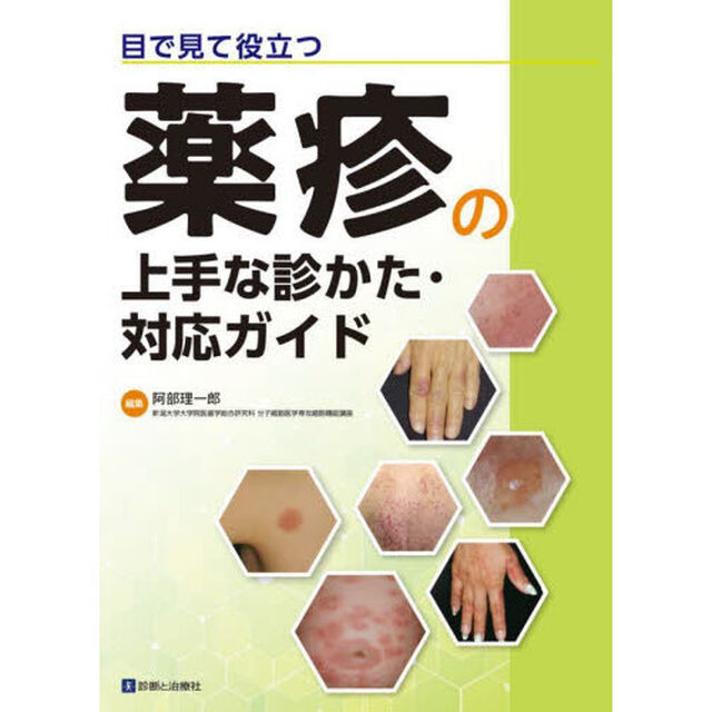 目で見て役立つ薬疹の上手な診かた・対応ガイド