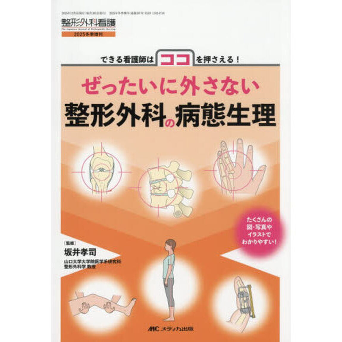 ぜったいに外さない整形外科の病態生理　できる看護師はココを押さえる！　たくさんの図・写真やイラストでわかりやすい！
