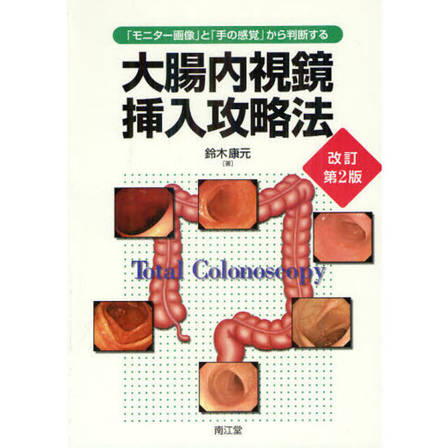 大腸内視鏡挿入攻略法　「モニター画像」と「手の感覚」から判断する「改訂第２版」