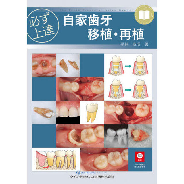 必ず上達自家歯牙移植・再植