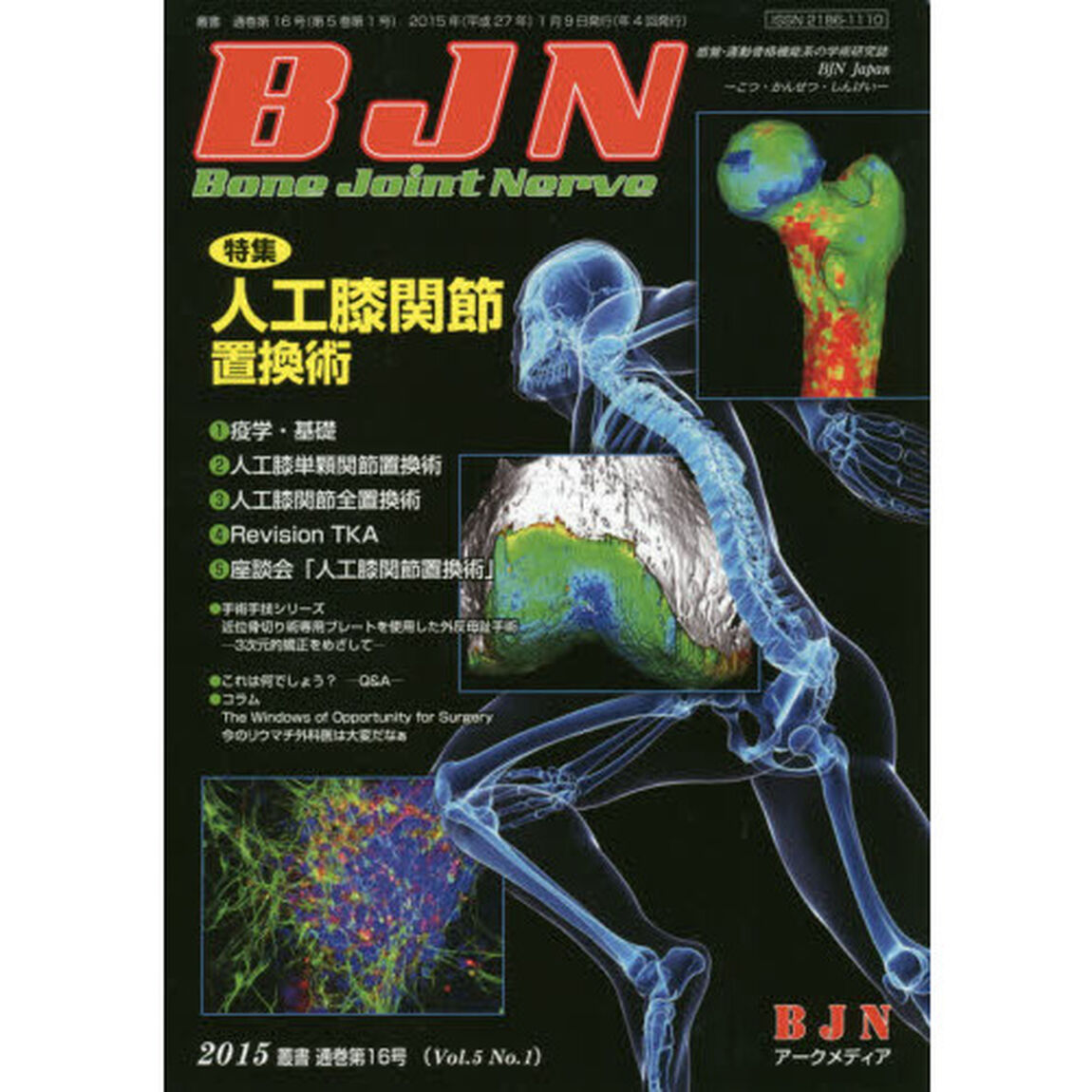 ＢｏｎｅＪｏｉｎｔＮｅｒｖｅ　　５－　１