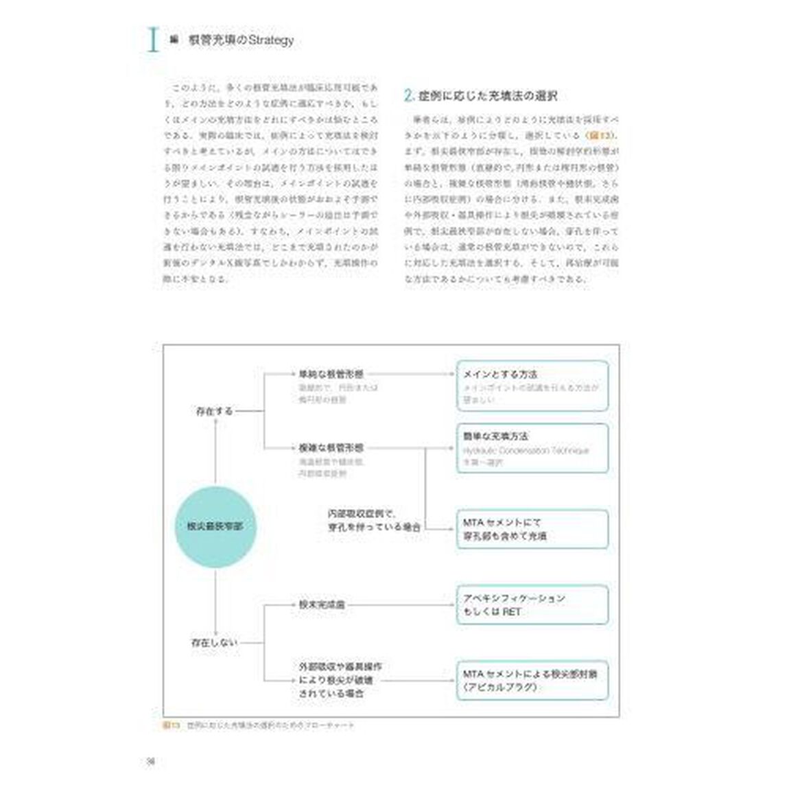 形態・状態に応じた根管充填　最適な根管充填法の選択と臨床応用
