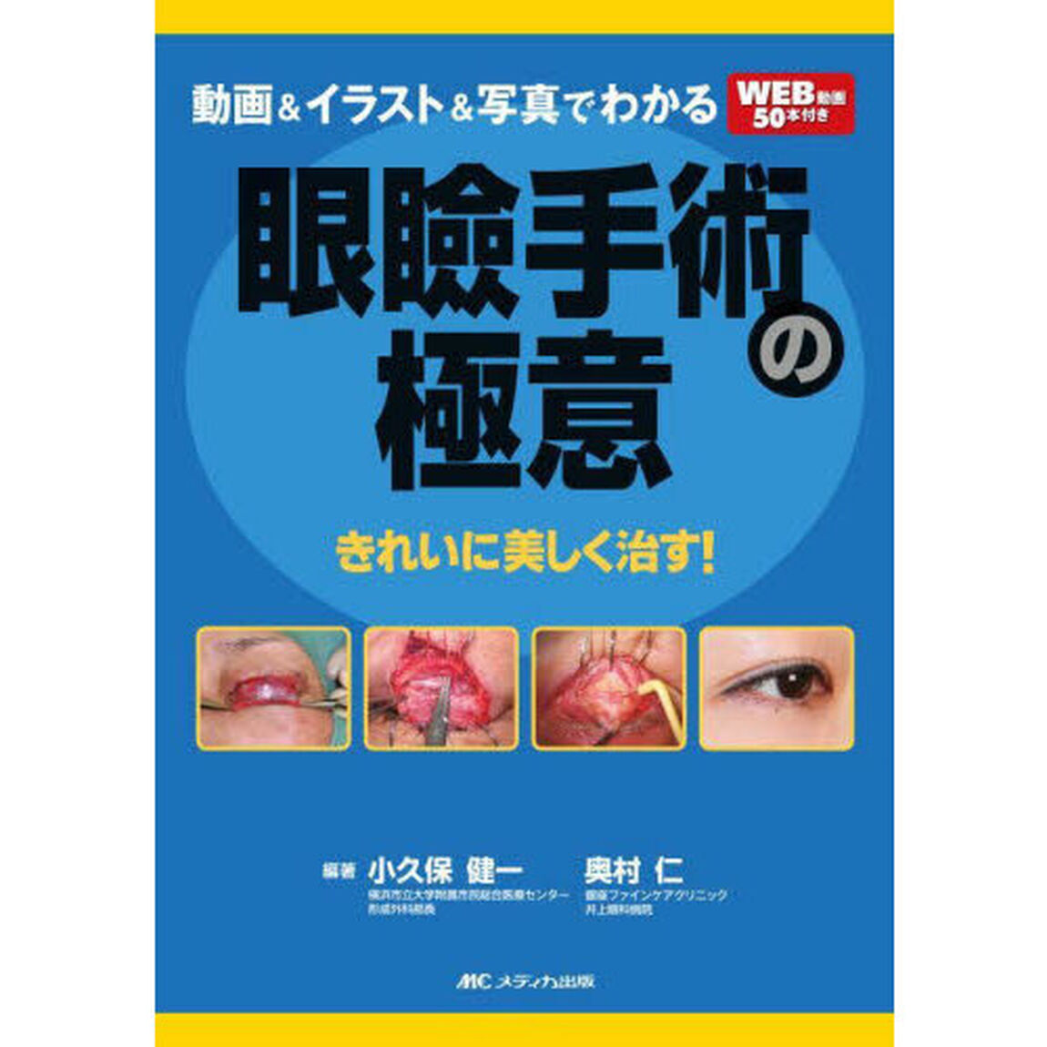 動画＆イラスト＆写真でわかる眼瞼手術の極意　きれいに美しく治す！