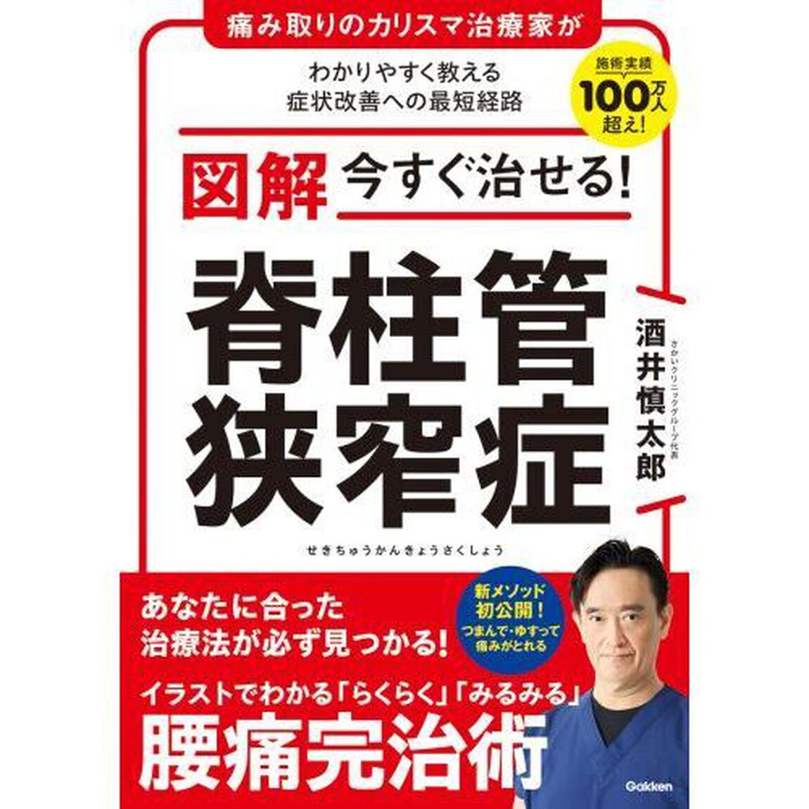 図解今すぐ治せる！脊柱管狭窄症　痛み取りのカリスマ治療家がわかりやすく教える症状改善への最短経路