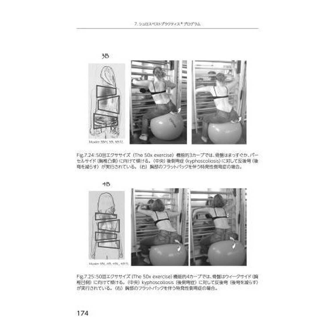 シュロスセラピー　最新のシュロス法による側弯症の保存療法〈運動療法・装具療法〉