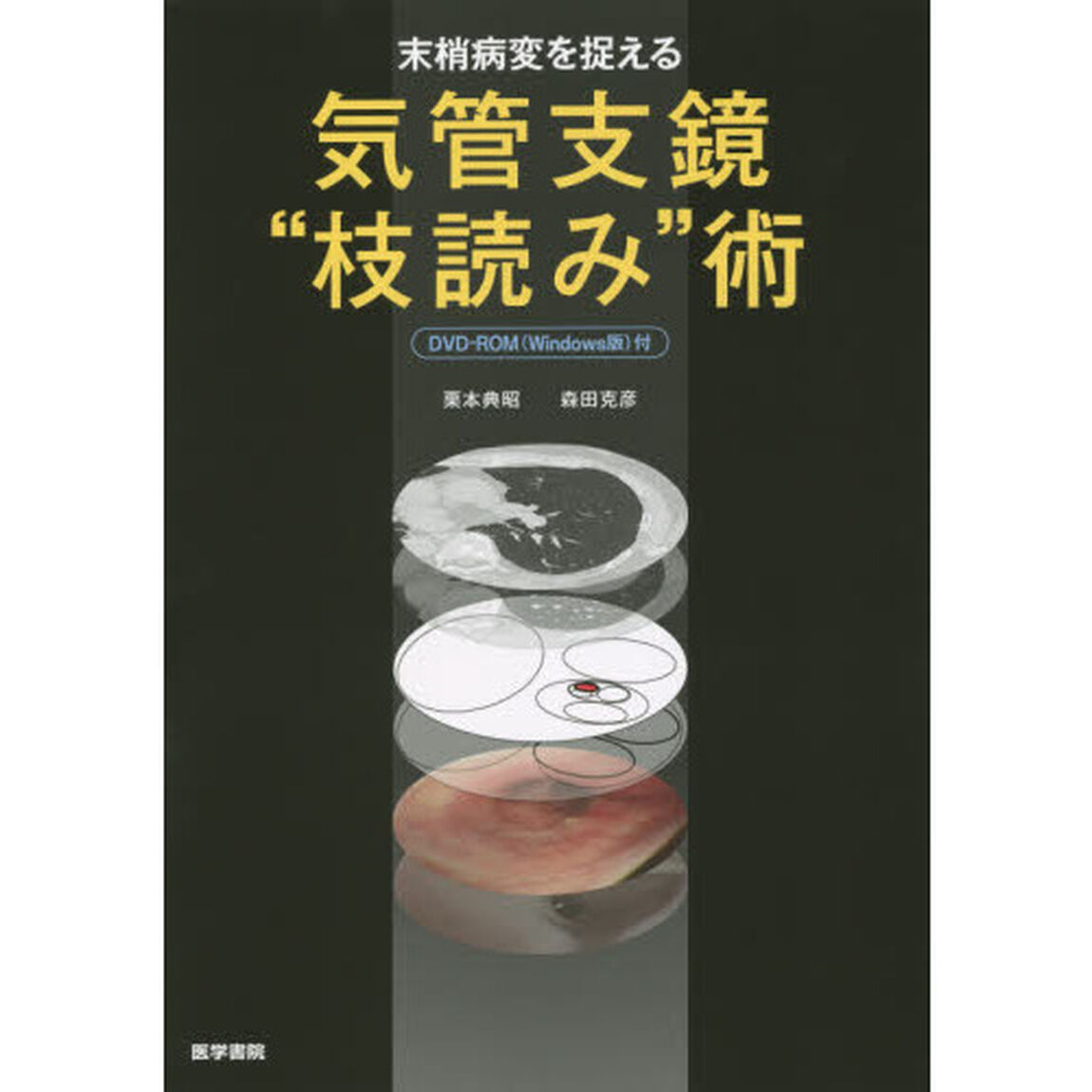 末梢病変を捉える気管支鏡&ldquo;枝読み&rdquo;術