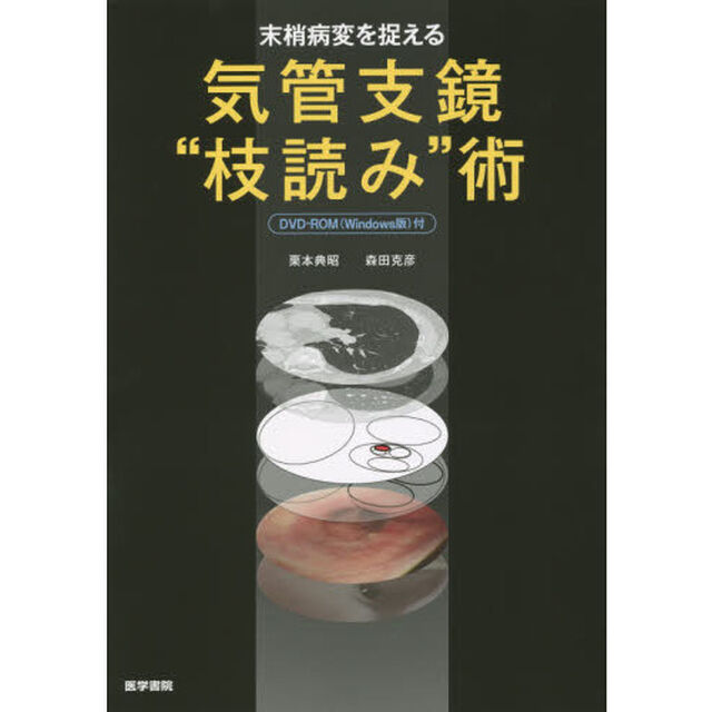末梢病変を捉える気管支鏡&ldquo;枝読み&rdquo;術