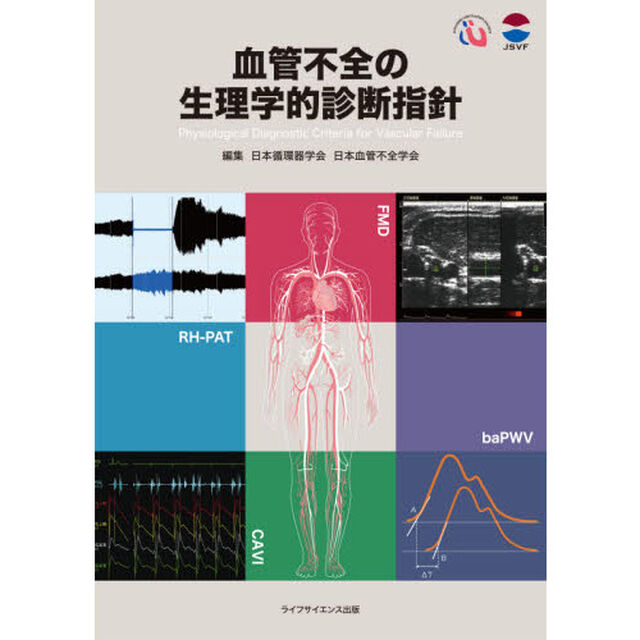 血管不全の生理学的診断指針
