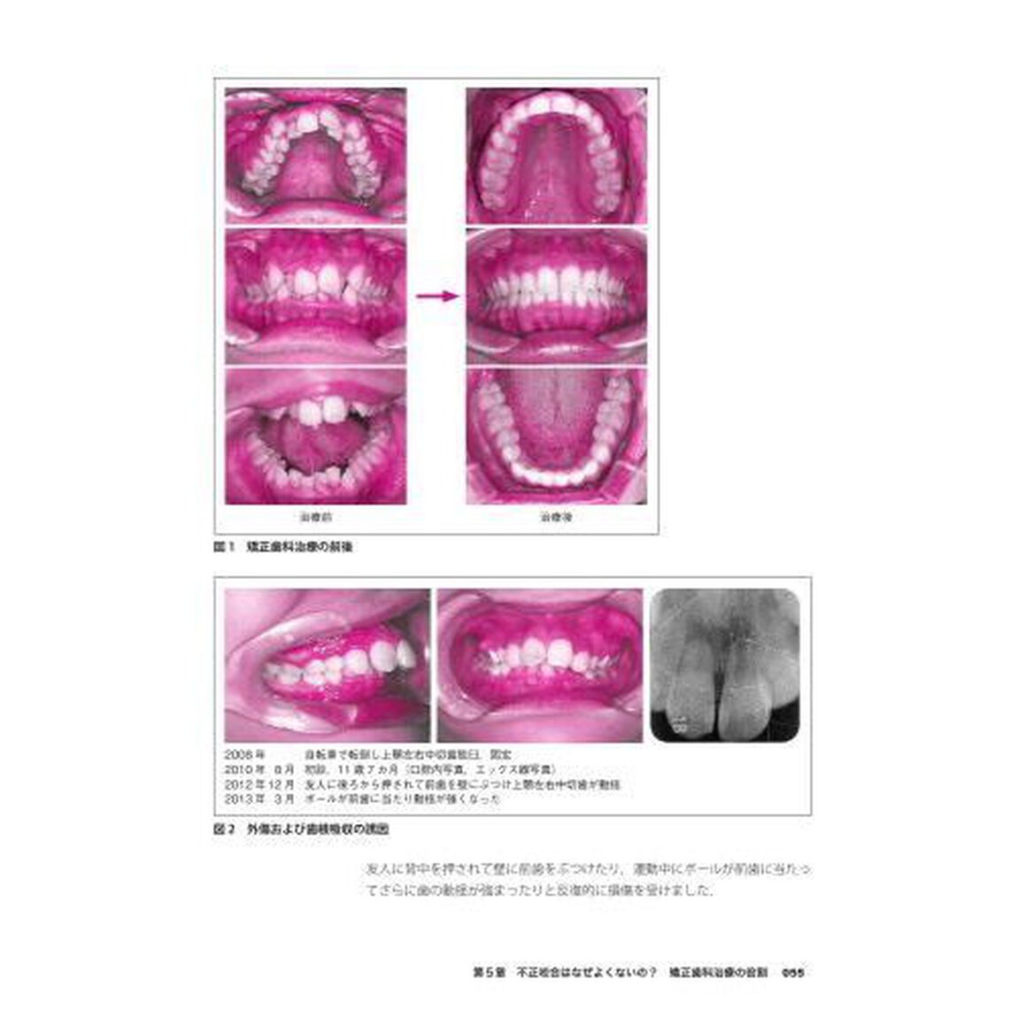やさしくわかる矯正歯科治療　歯並びコーディネーター入門書「第３版」