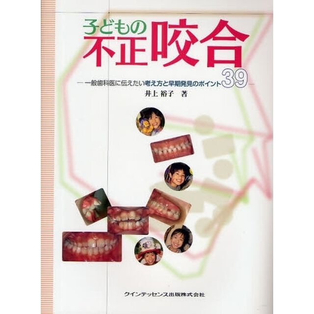 子どもの不正咬合　一般歯科医に伝えたい考え方と早期発見のポイント３９