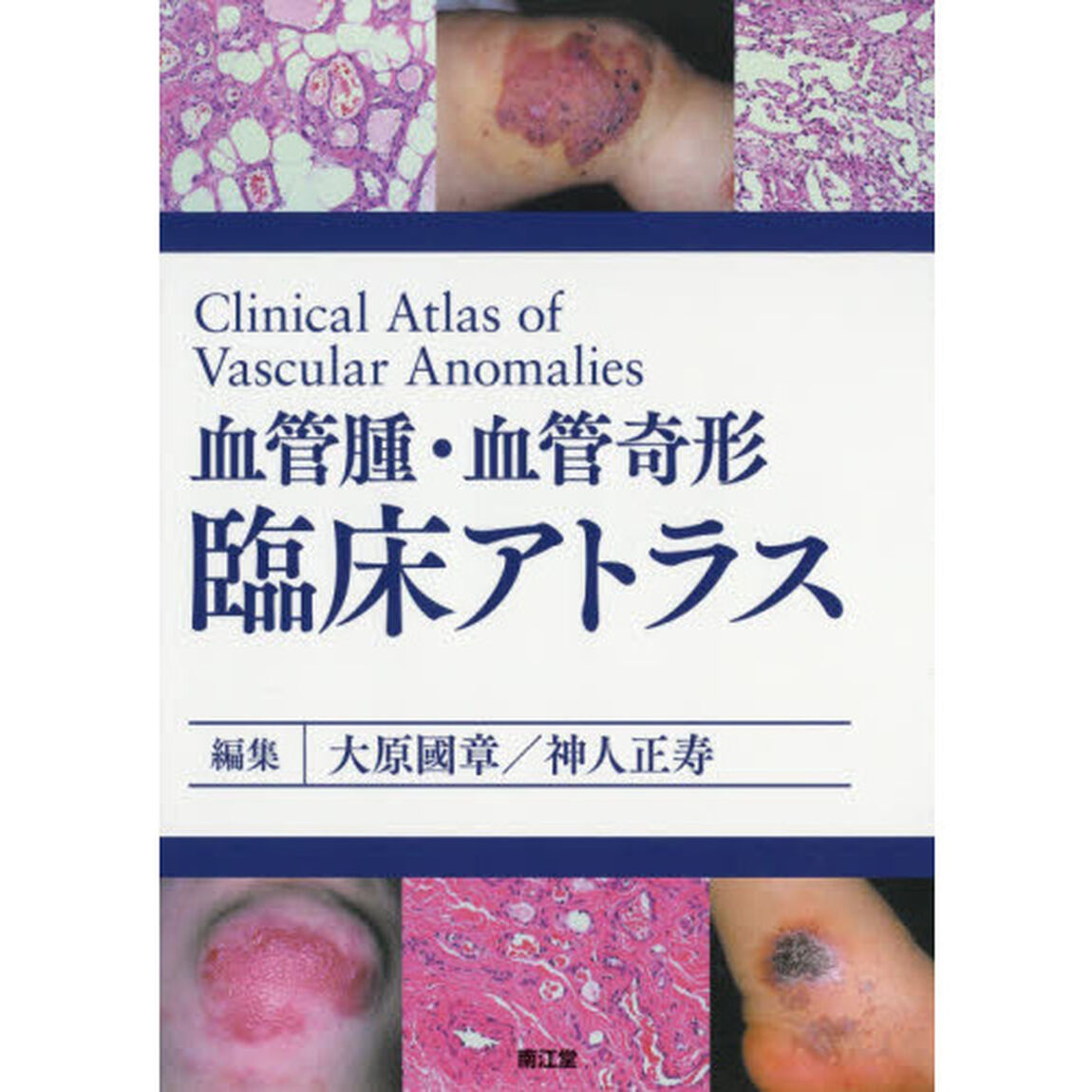血管腫・血管奇形臨床アトラス