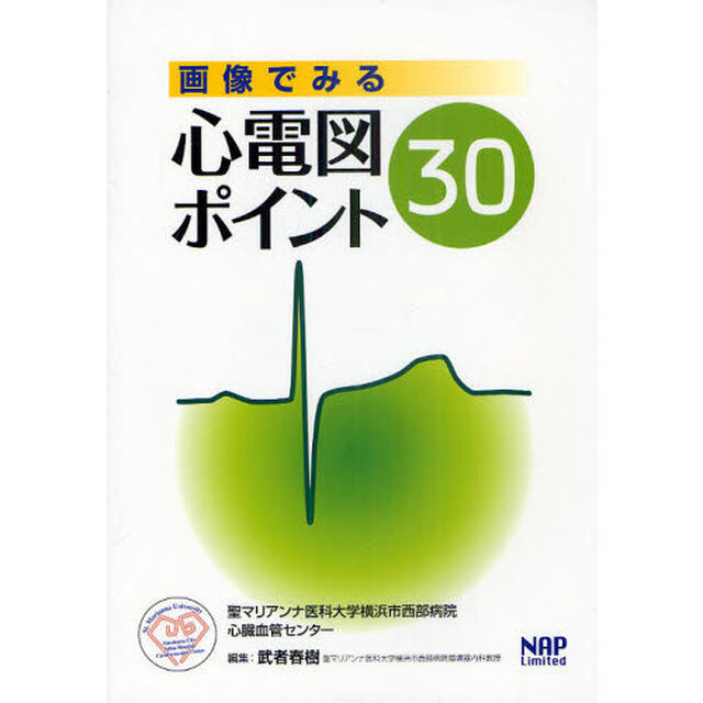 画像でみる心電図ポイント３０