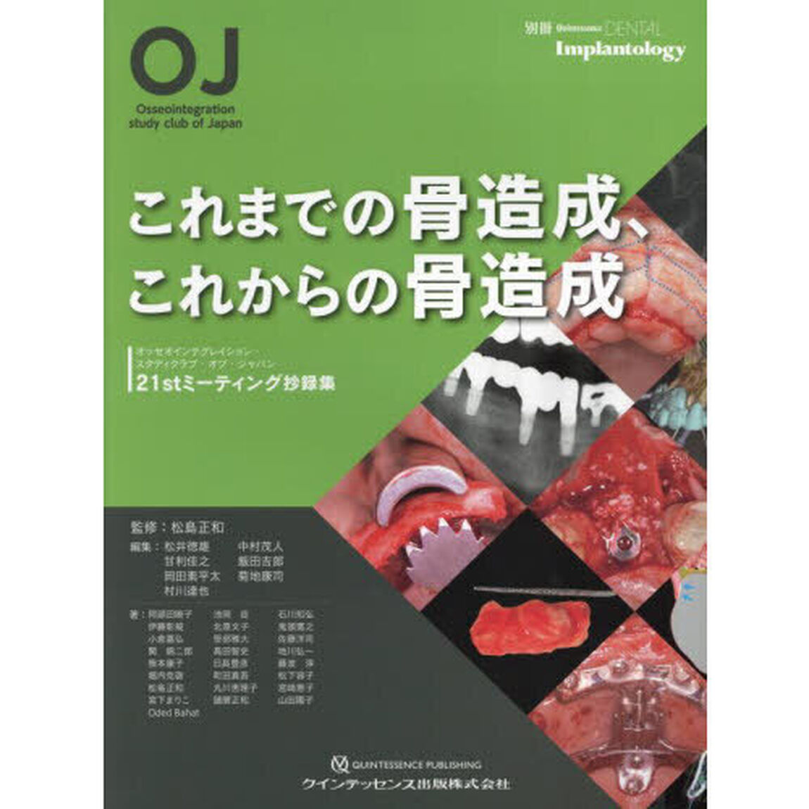 これまでの骨造成、これからの骨造成