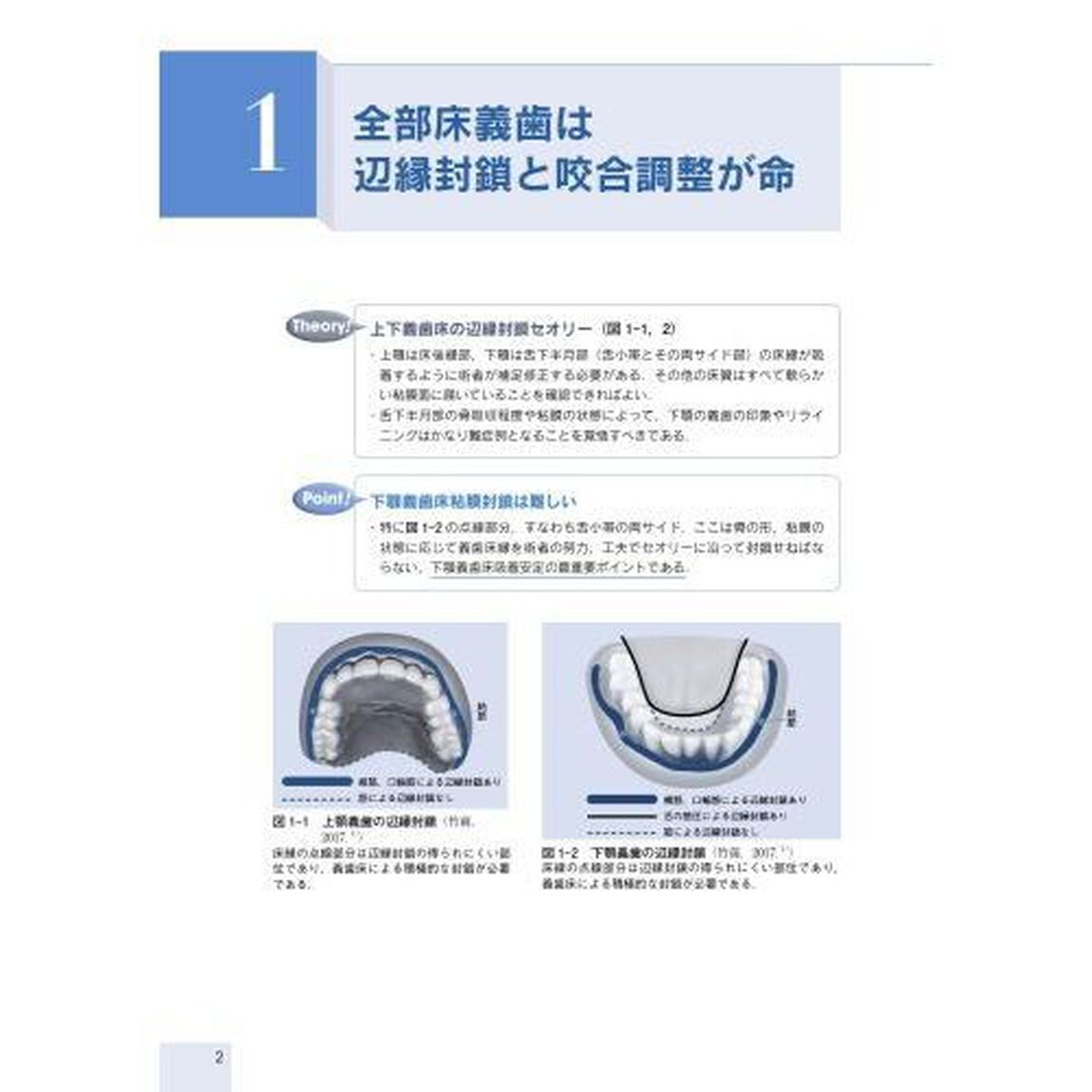 義歯治療こんなときどうする？　診療室・訪問現場で困ったときのセオリーとポイント