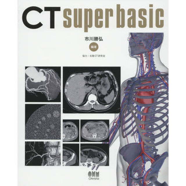 ＣＴ　ｓｕｐｅｒ　ｂａｓｉｃ