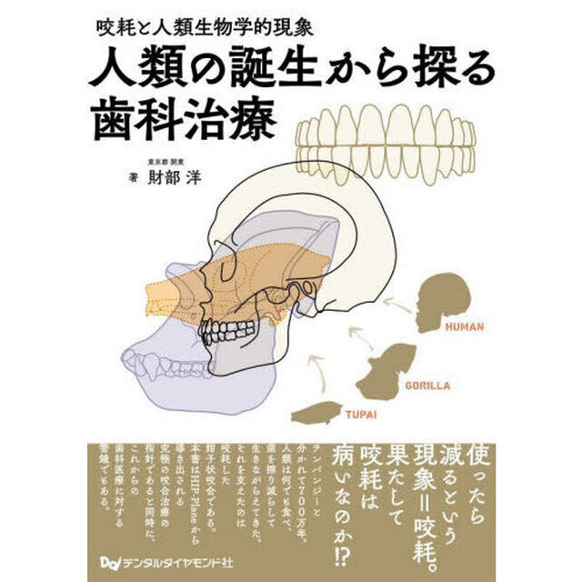 人類の誕生から探る歯科治療　咬耗と人類生物学的現象