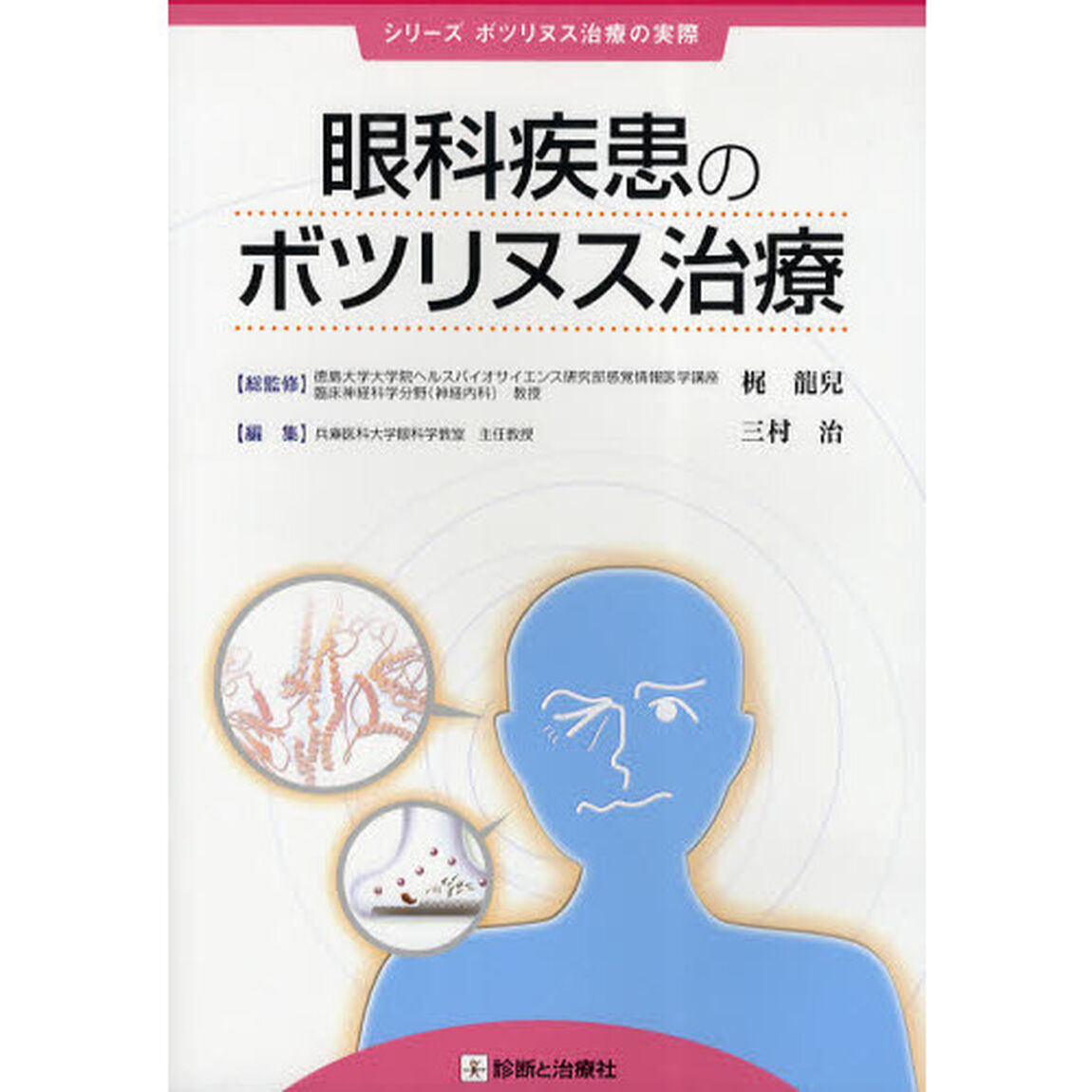 眼科疾患のボツリヌス治療