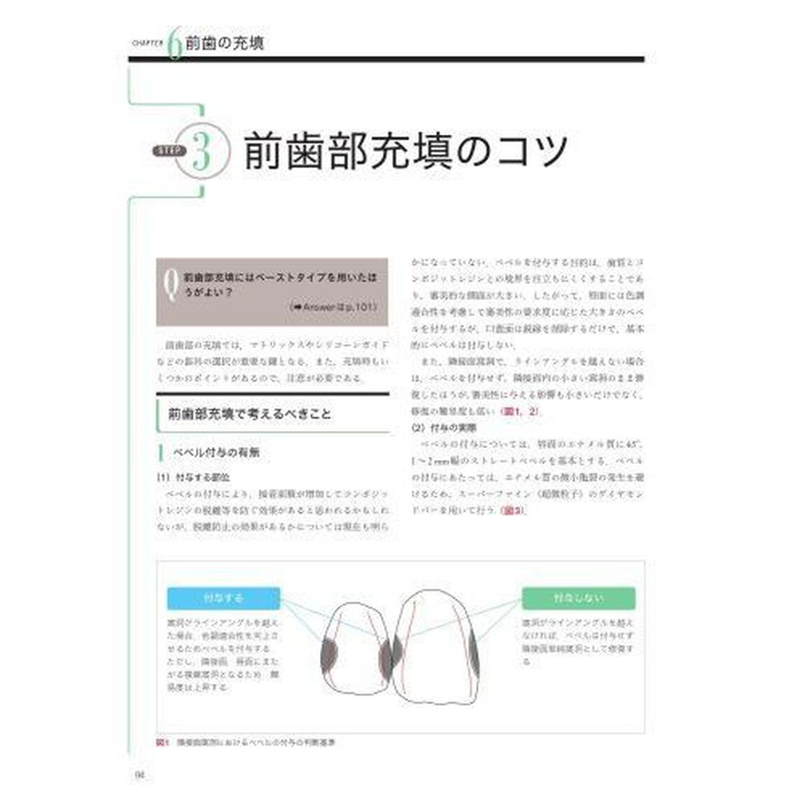 手に取るようにわかるコンポジットレジン修復のメソッド