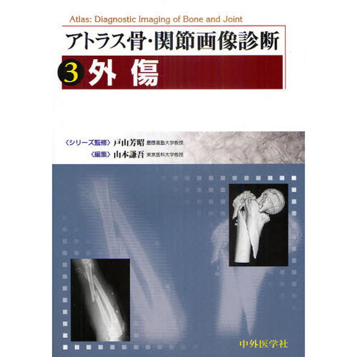 アトラス骨・関節画像診断　３「外傷」