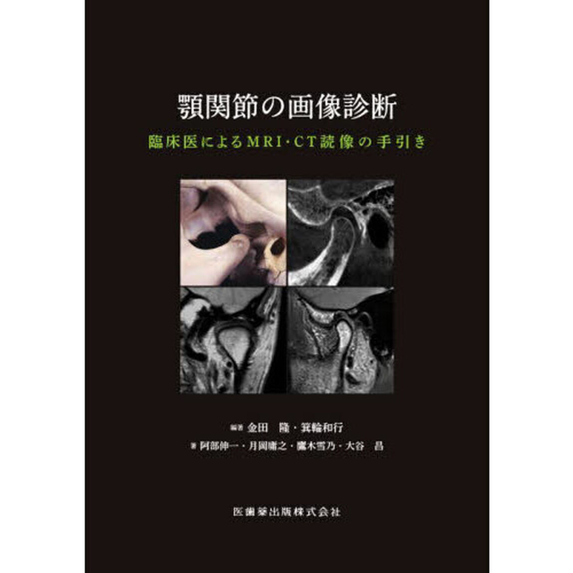 顎関節の画像診断　臨床医によるＭＲＩ・ＣＴ読像の手引き