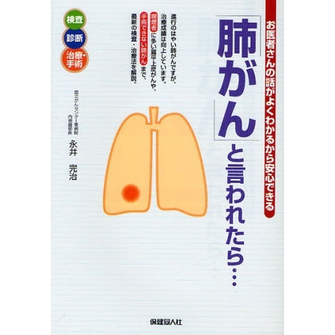 「肺がん」と言われたら&hellip;　喫煙者に多い肺がん、手術できない肺がんも解説