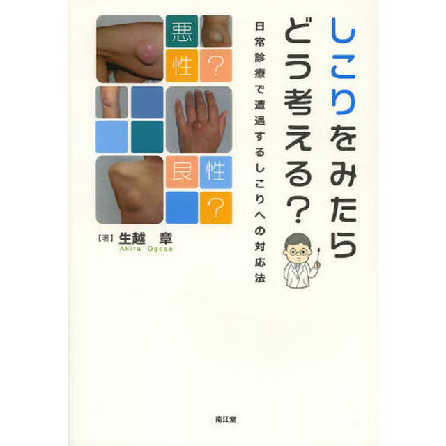 しこりをみたらどう考える？　日常診療で遭遇するしこりへの対応法