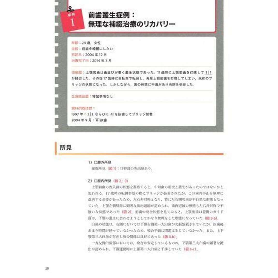 ＧＰが行う矯正治療を組み入れた咬合再構成　フローチャートでわかる治療計画立案