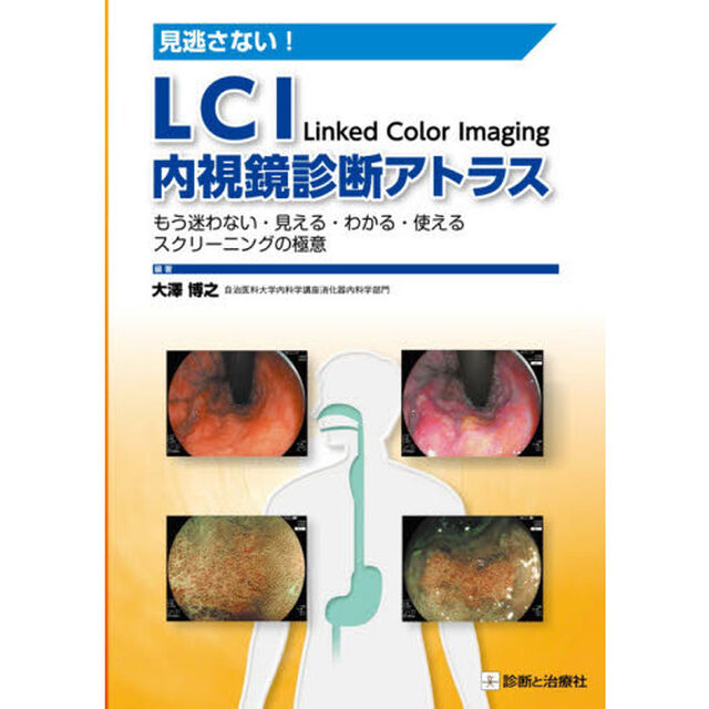 見逃さない！ＬＣＩ内視鏡診断アトラス　もう迷わない・見える・わかる・使えるスクリーニングの極意