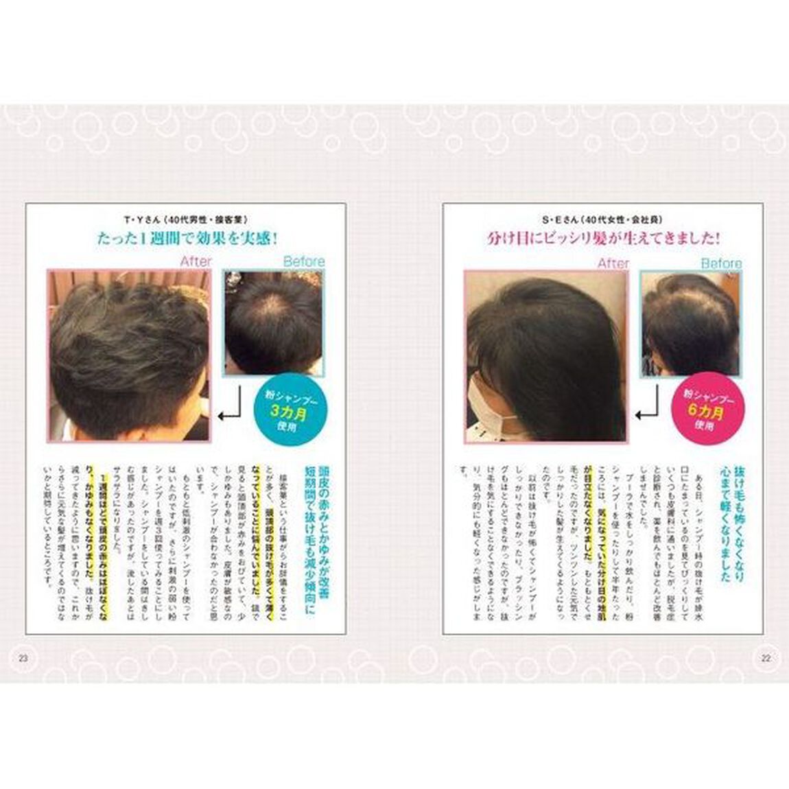 育毛のプロが教える髪が増える髪が太くなるすごい方法