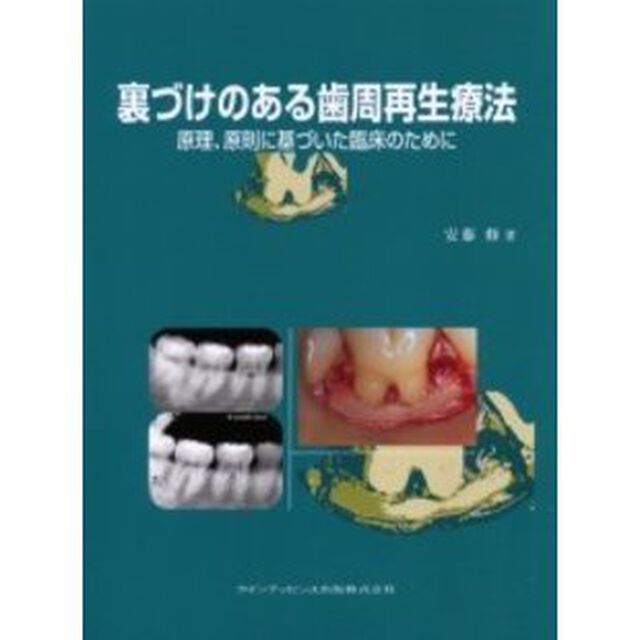 裏づけのある歯周再生療法　原理、原則に基づいた臨床のために
