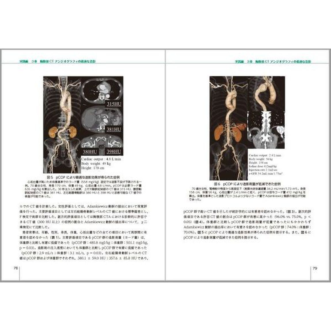 ｐＣＯＰの基礎と臨床応用　ＣＴにおける造影シミュレーション