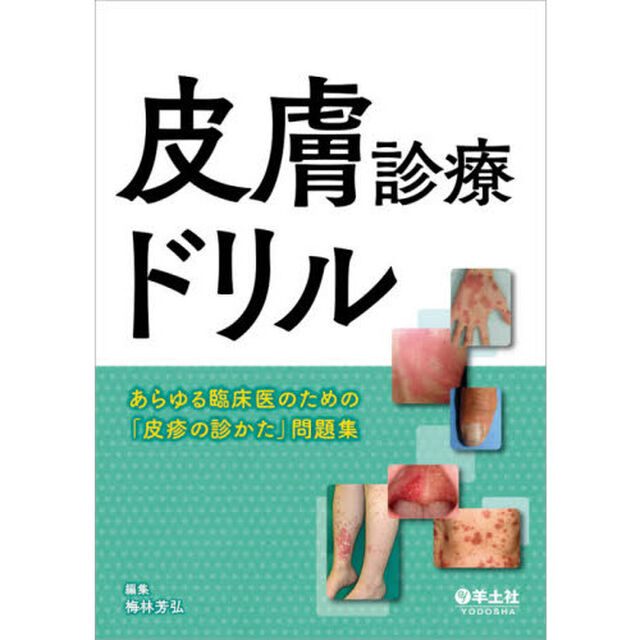 皮膚診療ドリル　あらゆる臨床医のための「皮疹の診かた」問題集