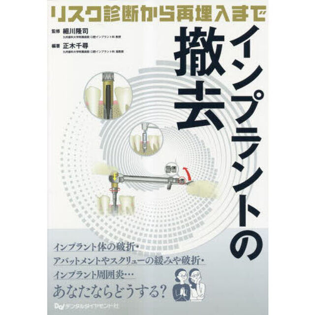 インプラントの撤去　リスク診断から再埋入まで