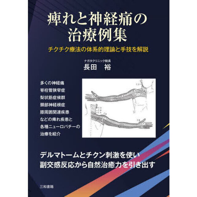 痺れと神経痛の治療例集　チクチク療法の体系的理論と手技を解説
