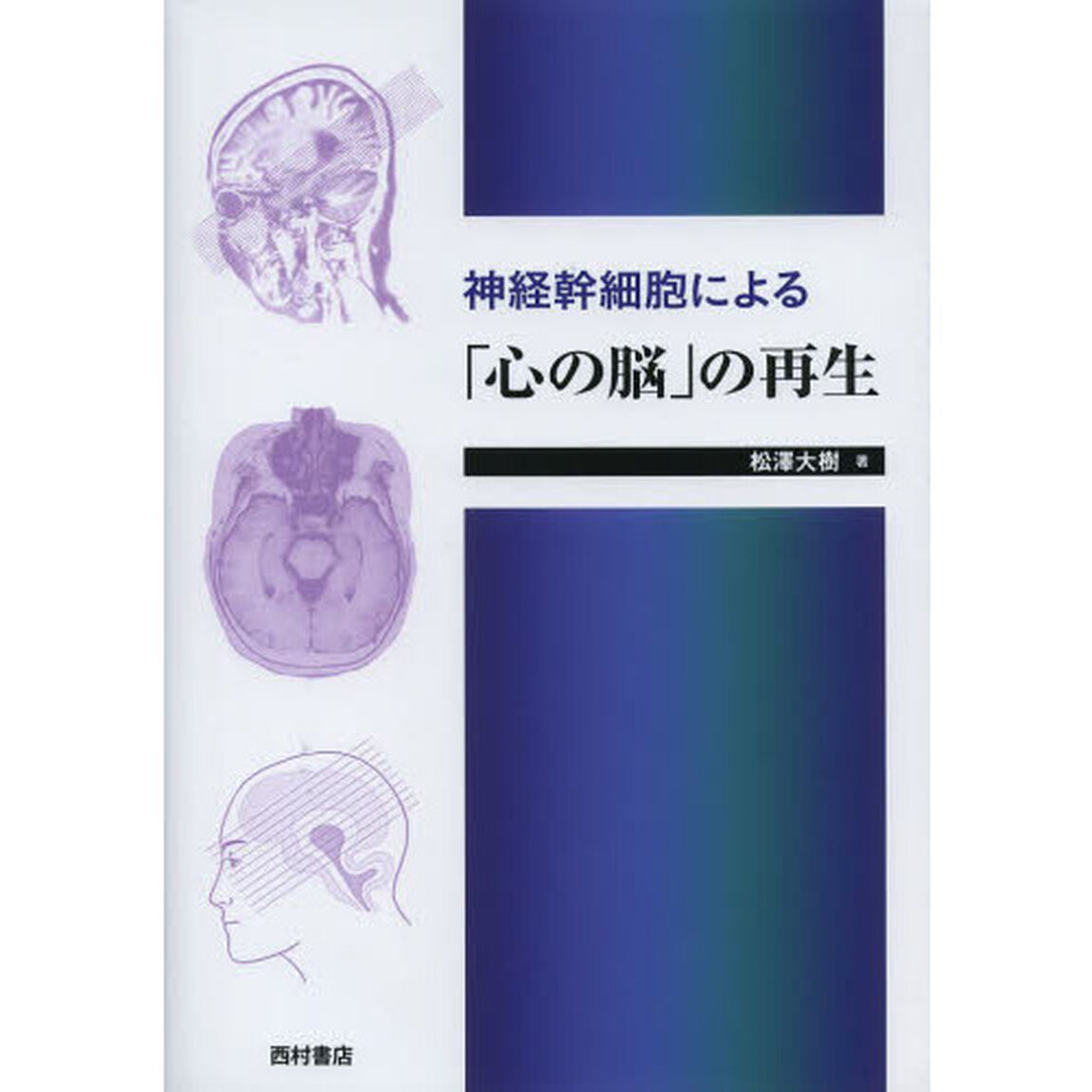 神経幹細胞による「心の脳」の再生