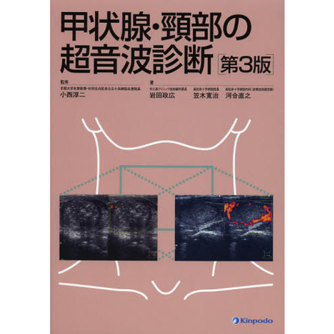 甲状腺・頸部の超音波診断「第３版」
