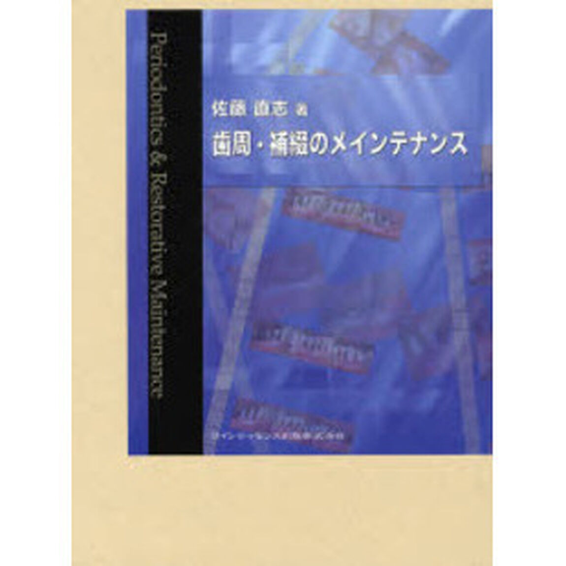 歯周・補綴のメインテナンス