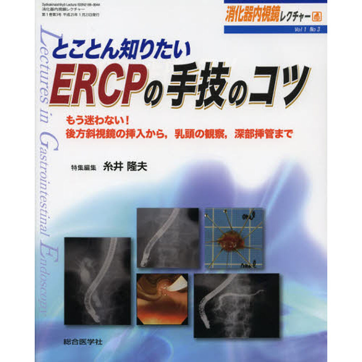 消化器内視鏡レクチャー　Ｖｏｌ１Ｎｏ３「とことん知りたいＥＲＣＰの手技のコツ　もう迷わない！後方斜視鏡の挿入から，乳頭の観察，深部挿管まで」