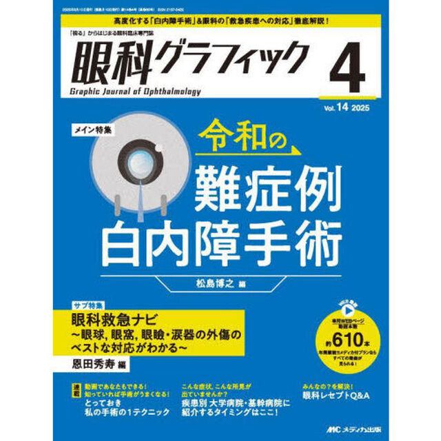 眼科グラフィック　「視る」からはじまる眼科臨床専門誌　第１４巻４号（２０２５－４）「令和の難症例白内障手術／眼科救急ナビ」