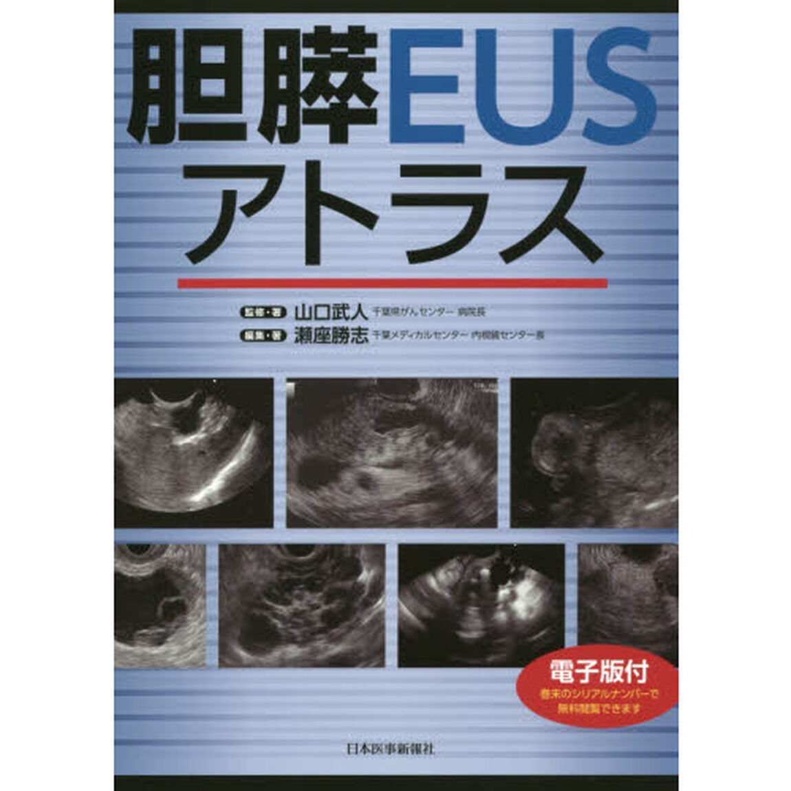 胆膵ＥＵＳアトラス