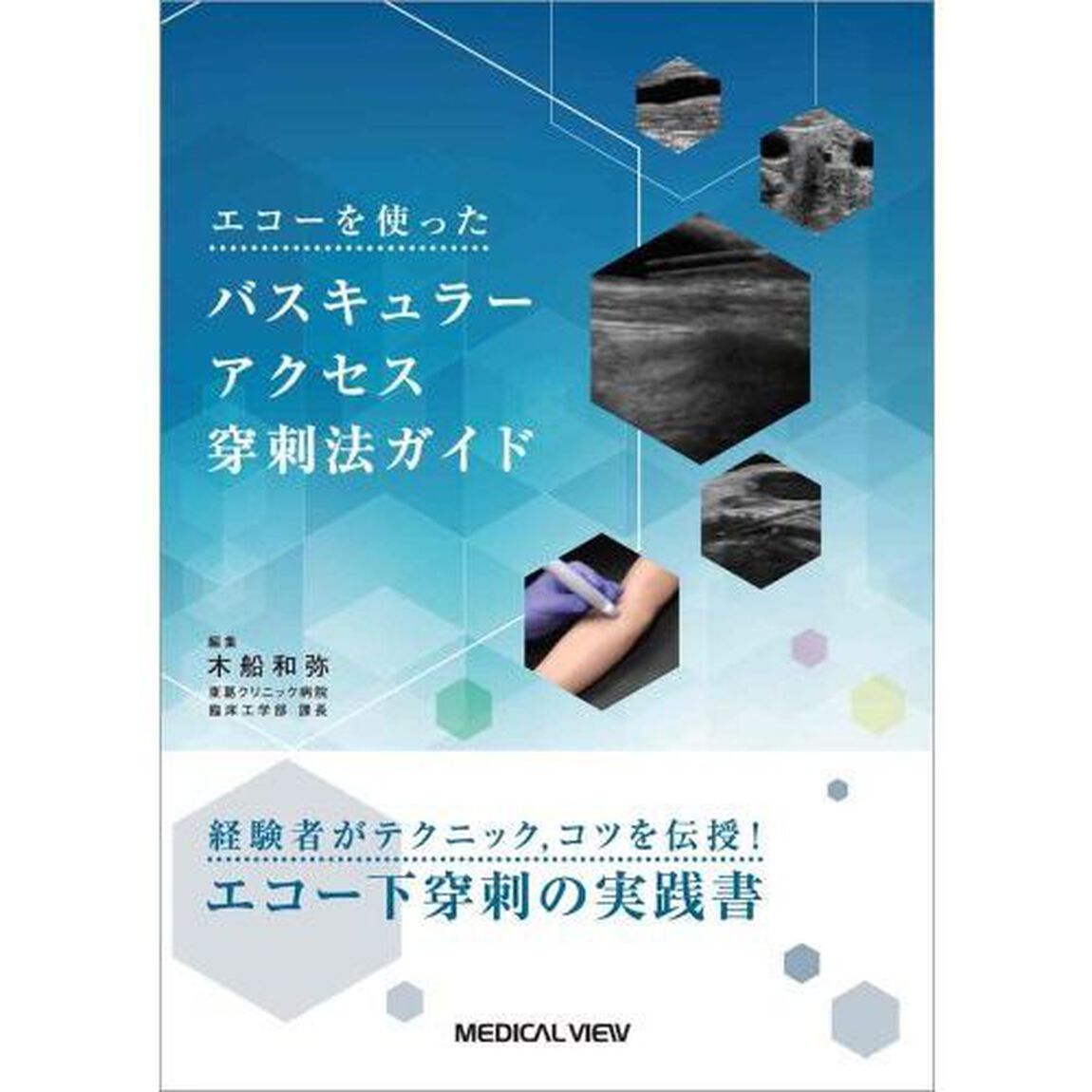 エコーを使ったバスキュラーアクセス穿刺法ガイド