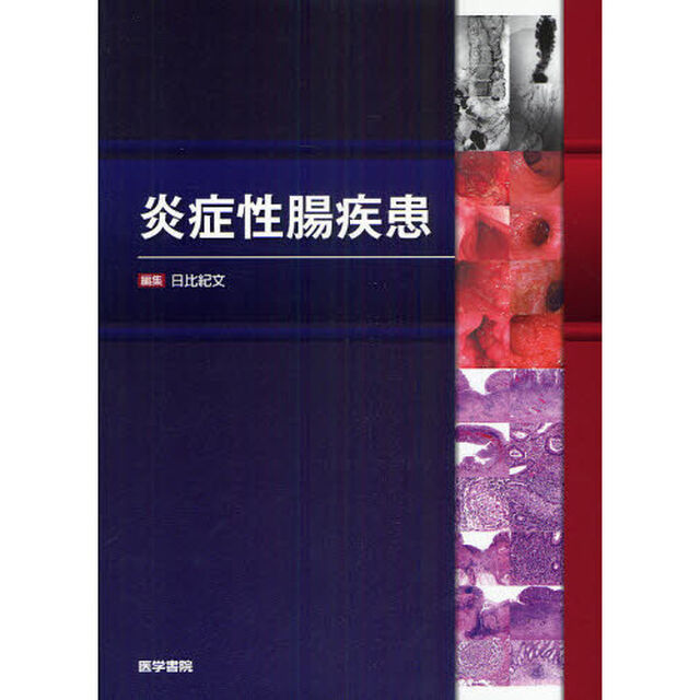 炎症性腸疾患