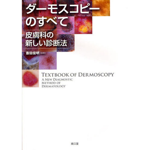 ダーモスコピーのすべて　皮膚科の新しい診断法