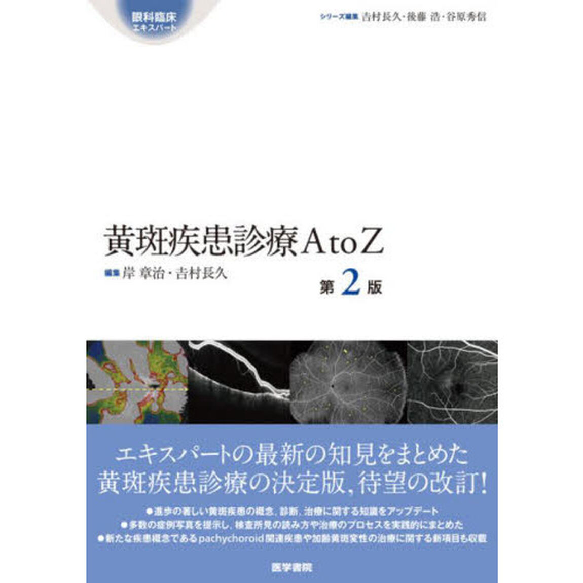 黄斑疾患診療Ａ　ｔｏ　Ｚ「第２版」