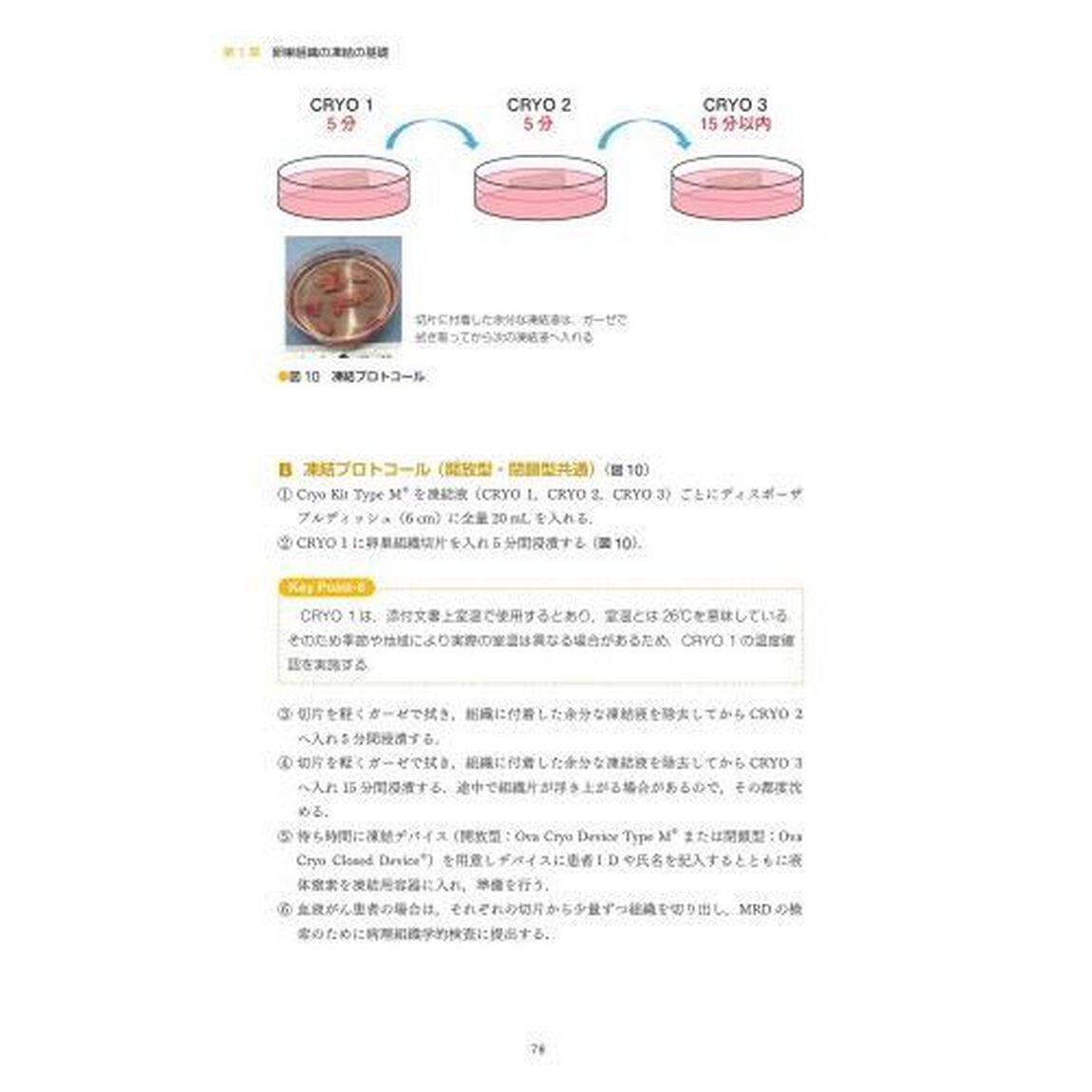 卵巣組織凍結・移植　新しい妊孕性温存療法の実践「新版」