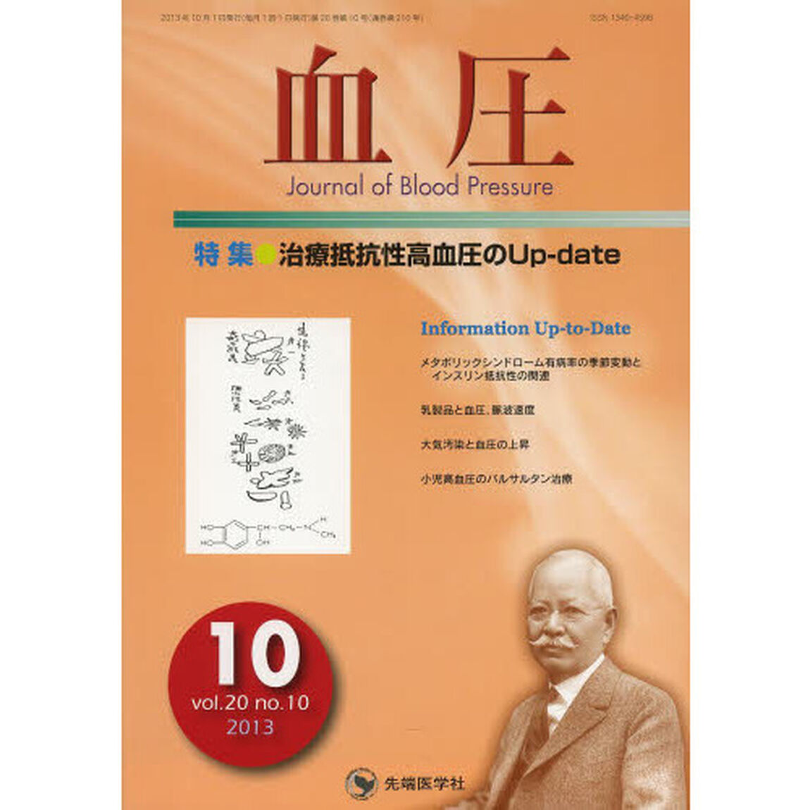 血圧　ｖｏｌ．２０ｎｏ．１０（２０１３－１０）「特集●治療抵抗性高血圧のＵｐ‐ｄａｔｅ」