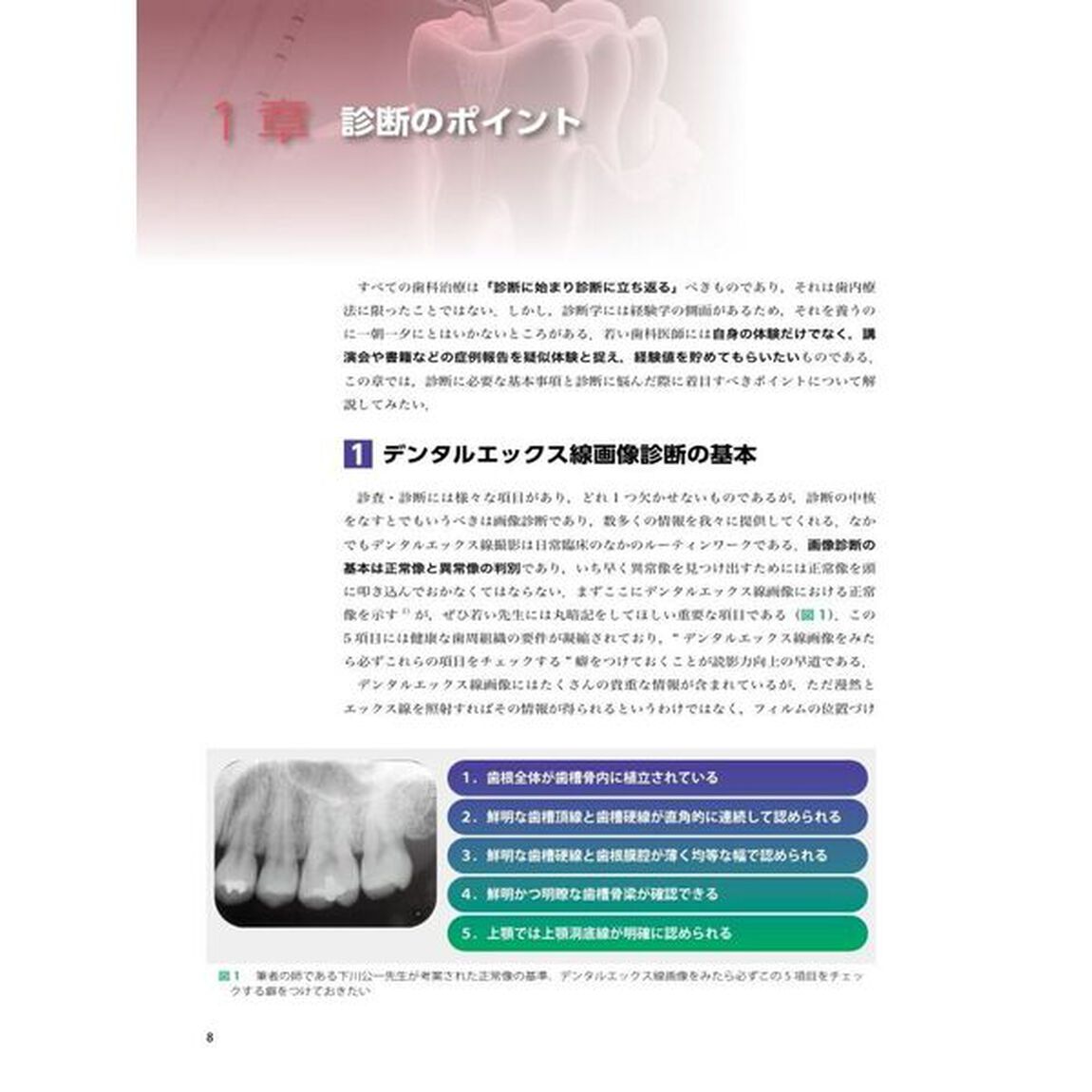 チェックリストで見直す上達必至の歯内療法